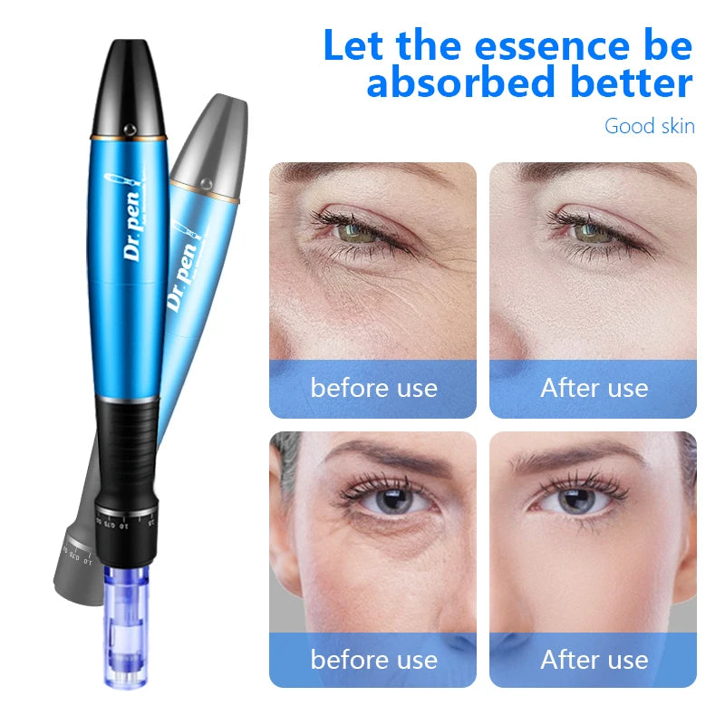 Electric Microneedling Derma Pen – 5-Speed Facial Tool