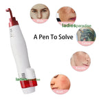 Picosecond Laser Pen for Dark Spot and Tattoo Removal