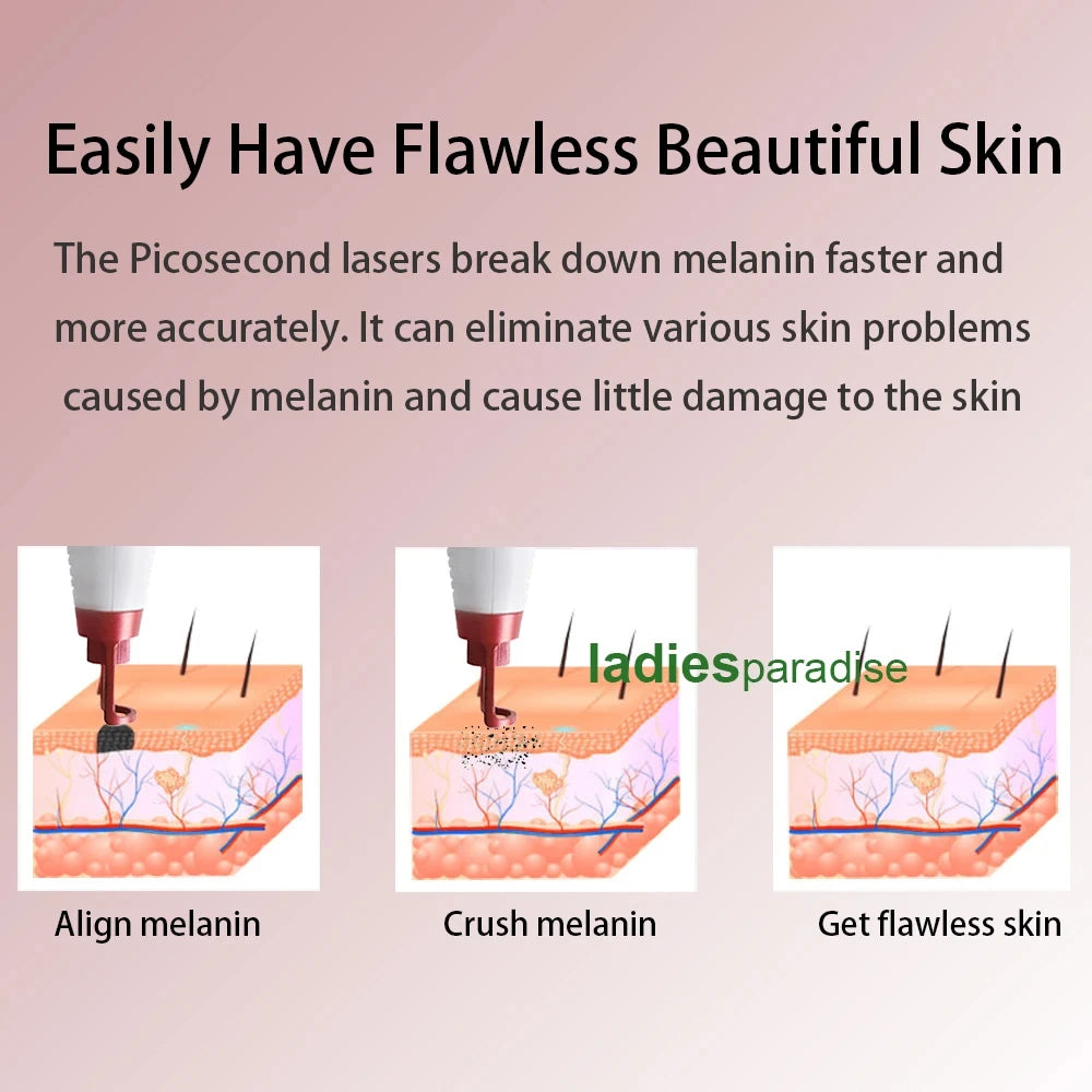 Picosecond Laser Pen for Dark Spot and Tattoo Removal