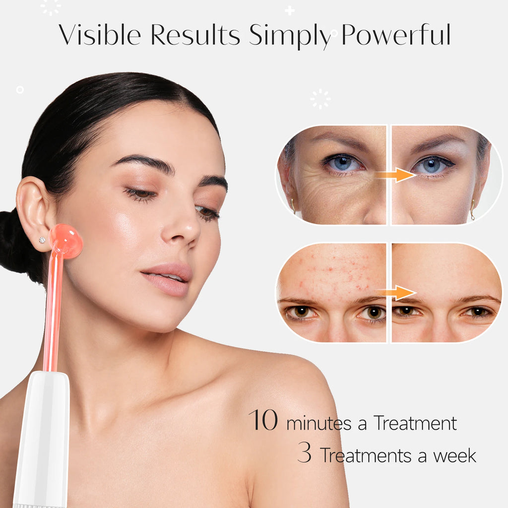 High Frequency Facial Wand for Acne and Wrinkles
