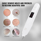 Laser Plasma Skin Care Pen – 10-Level Adjustable