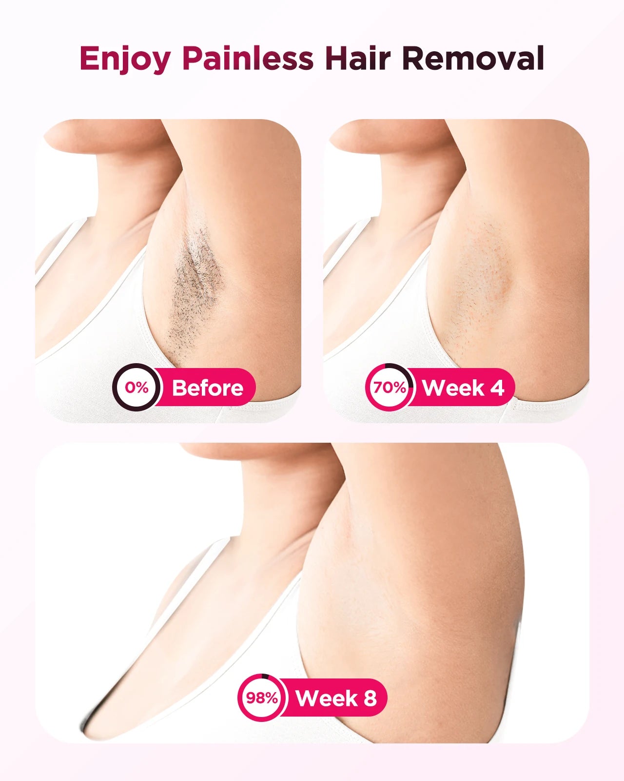IPL Laser Hair Removal Device – At-Home Full Body Epilator