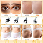 4-in-1 Ultrasonic Cavitation RF Vacuum Body Shaper