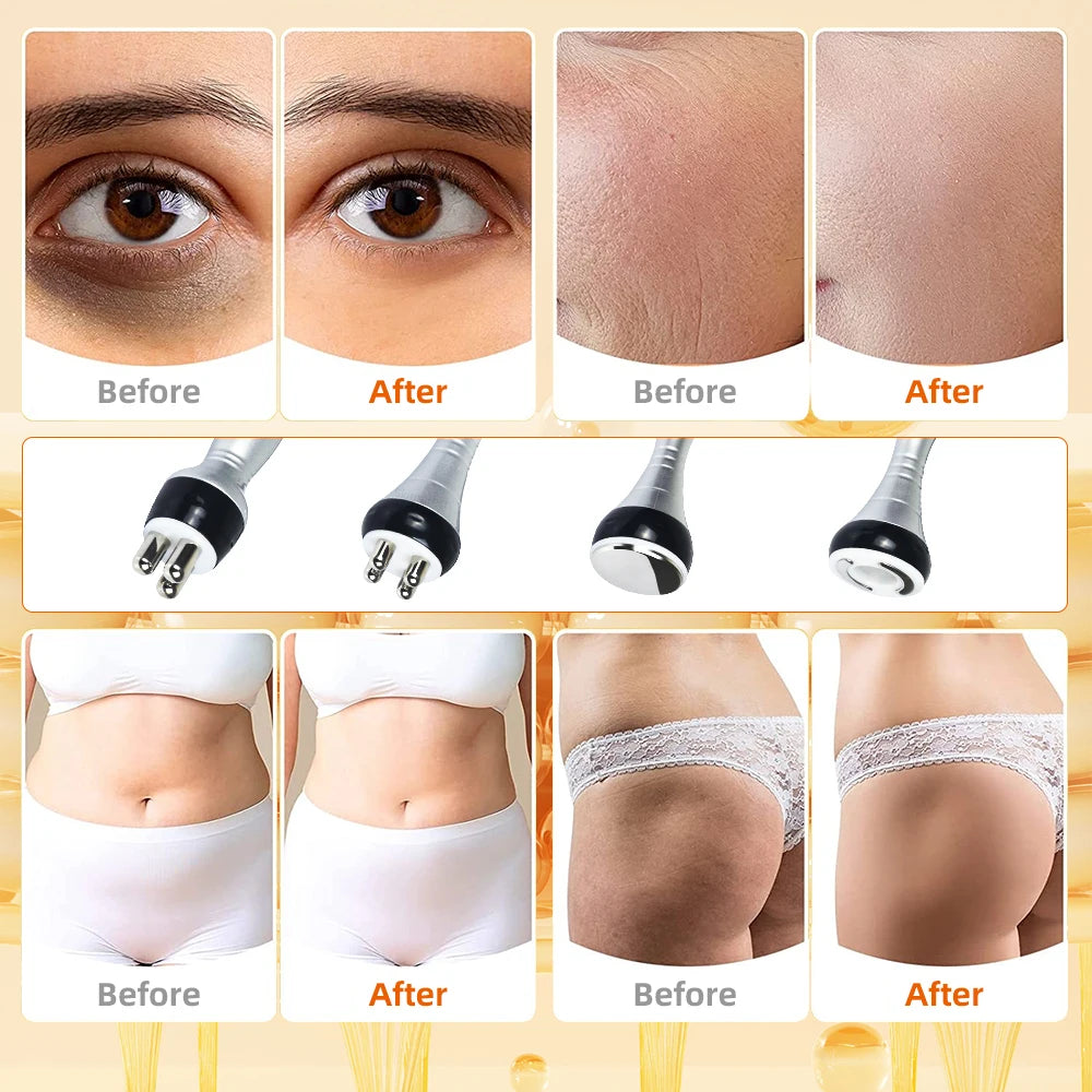 4-in-1 Ultrasonic Cavitation RF Vacuum Body Shaper